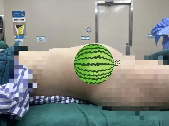 湘潭一33岁女子差点丢了子宫
