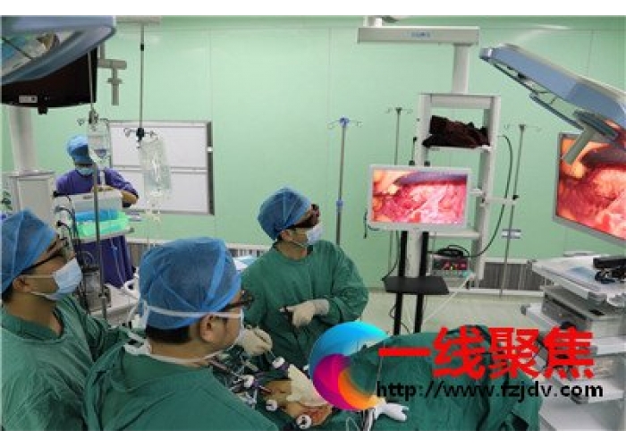湘潭市第一人民医院引进新一代3D高清腹腔镜成功实施肠癌根治术